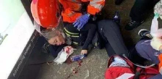 煽动仇警并悄悄＂消失＂的香港＂爆眼女＂ ，败诉了