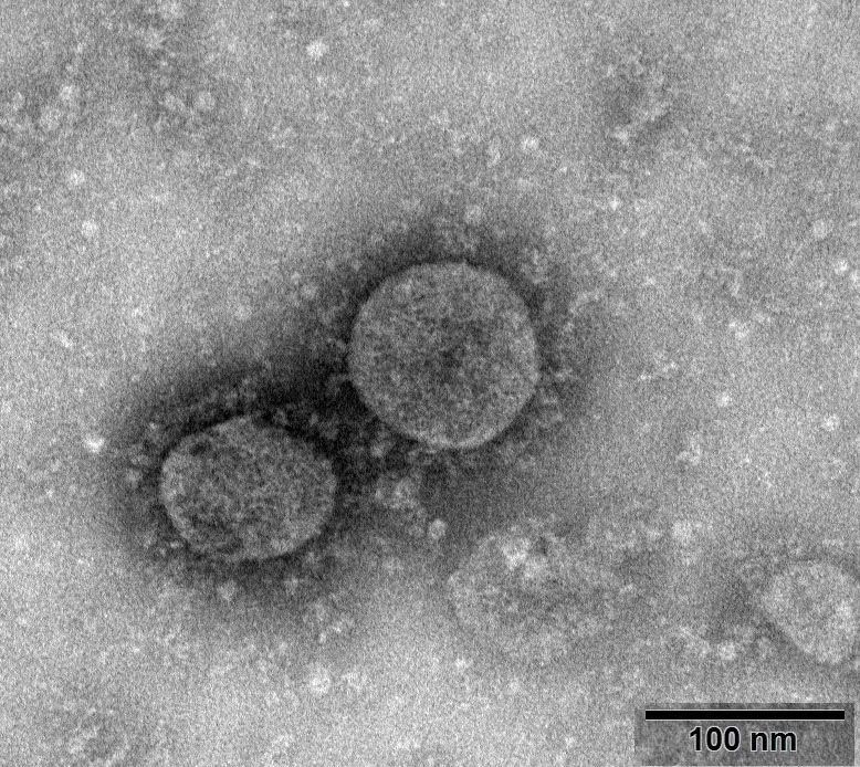 新型冠状病毒武汉株02 照片来源:国家病原微生物资源库(中国疾病预防控制中心病毒病预防控制所)