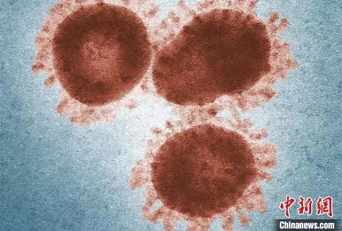 显微镜下的SARS冠状病毒(图片来源:www.cdc.gov) 中科院上海巴斯德所/供图