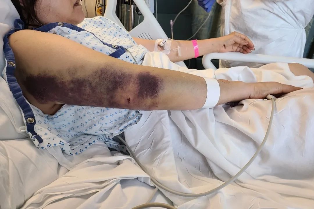老板娘全身多处受伤,大腿严重骨折。(WABC视频新闻截图)