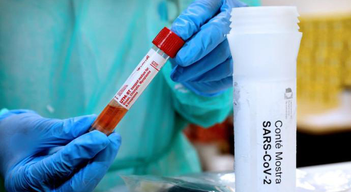 西班牙去年3月废水样本中检出新冠病毒