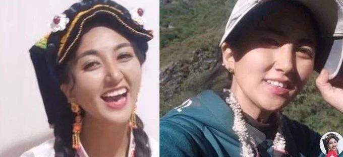 网红拉姆直播时被前夫烧伤生命垂危，已转至成都治疗