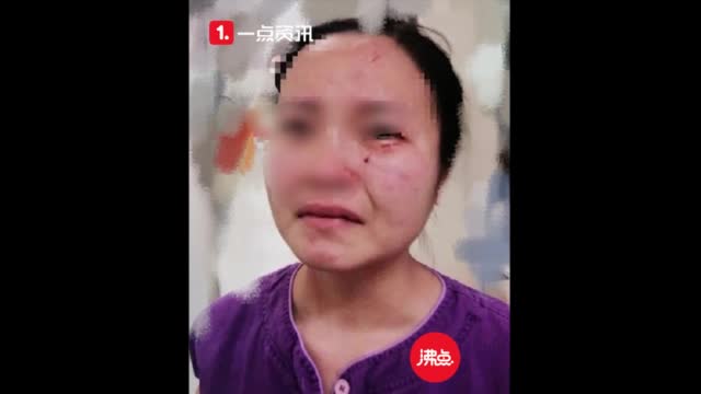 广州通报外籍新冠肺炎患者打伤护士：已立刑事案件调查