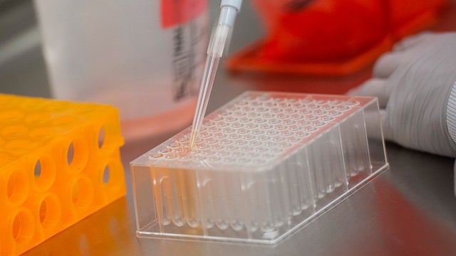 美媒：美国应与中国为新冠疫苗合作 别坐视死亡