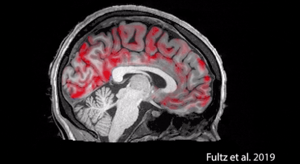 科学家首次拍到：人睡着时清洗大脑全过程！