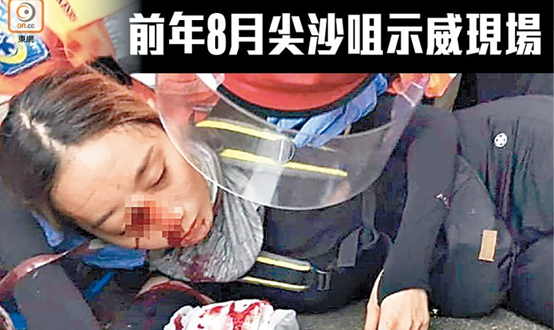 港媒爆料&ldquo;独家消息&rdquo;：&ldquo;爆眼少女&rdquo;原来没&ldquo;爆眼&rdquo;
